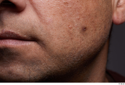 Face Mouth Cheek Skin Man Birthmarks Chubby Studio photo references